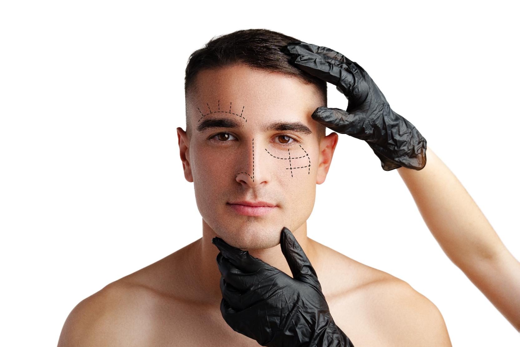 Male patient with facial markings during cosmetic consultation while gloved hands examine face