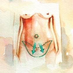 C. Abdominal skin and fat are stretched downward, the excess is removed, and a new opening is made for the belly button. After surgery, the scar is easily hidden in underwear or a bikini bottom.