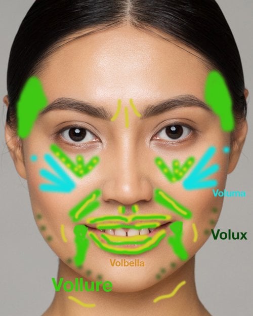 Filler guide front