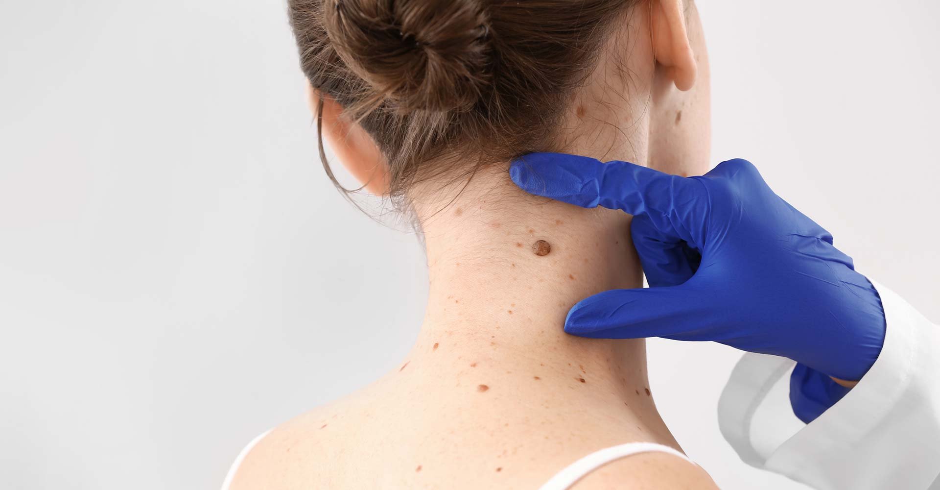 Dermatologist examining moles of patient on light background