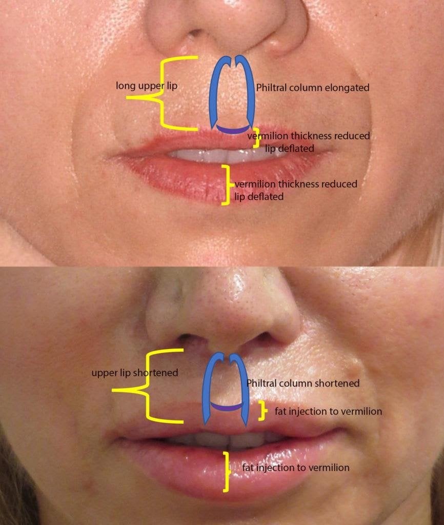 Facial proportions and anatomy