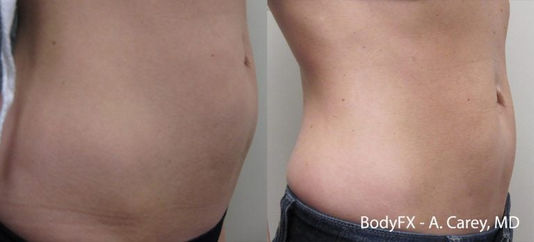 BodyFX - 1