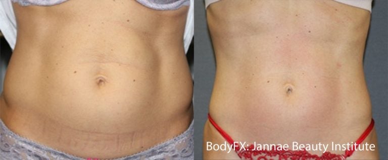 BodyFX front - 10