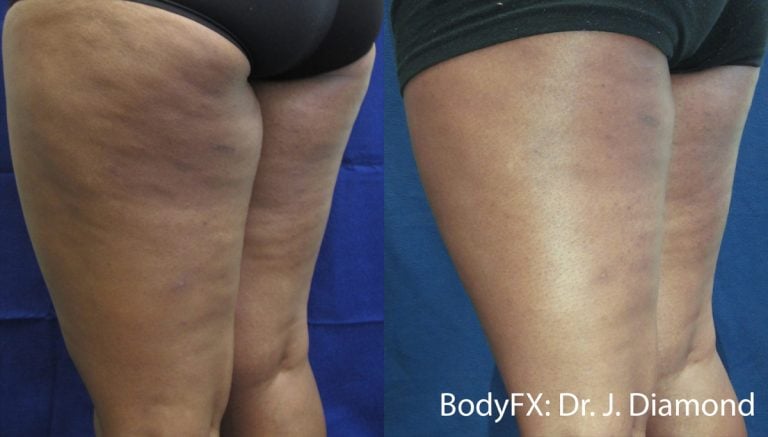 BodyFX - Scaled - 11