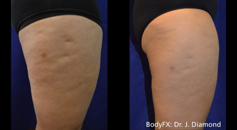 BodyFX – Scaled - 12