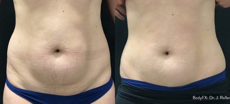BodyFX – Scaled - 13