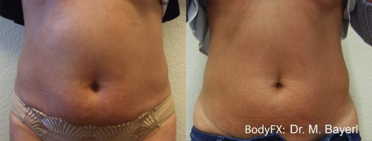 BodyFX - 14