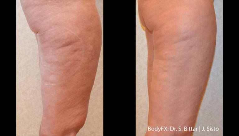 BodyFX – Scaled - 15