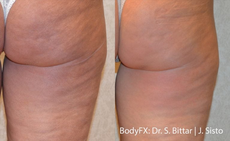 BodyFX - 15