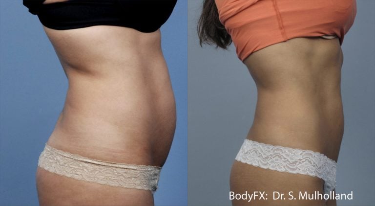 BodyFX – Scaled - 16