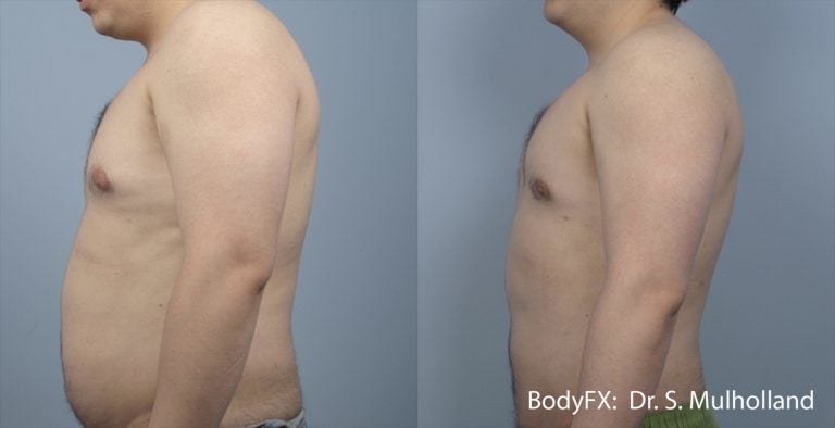 BodyFX – Male