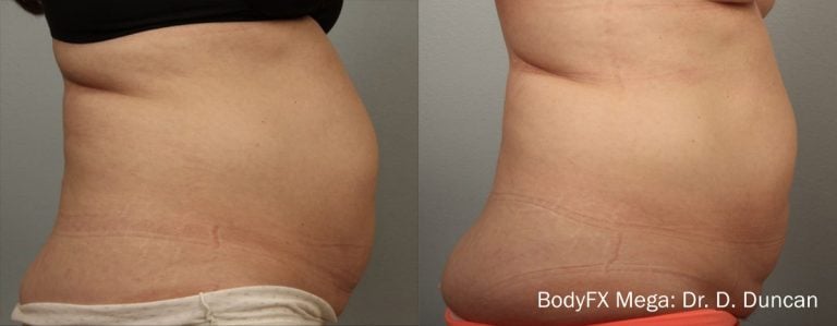 BodyFX Mega - 3