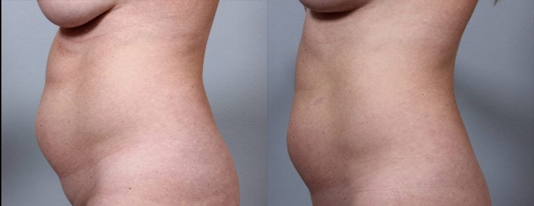 BodyFX - 5