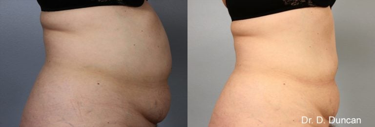 BodyFX - 6