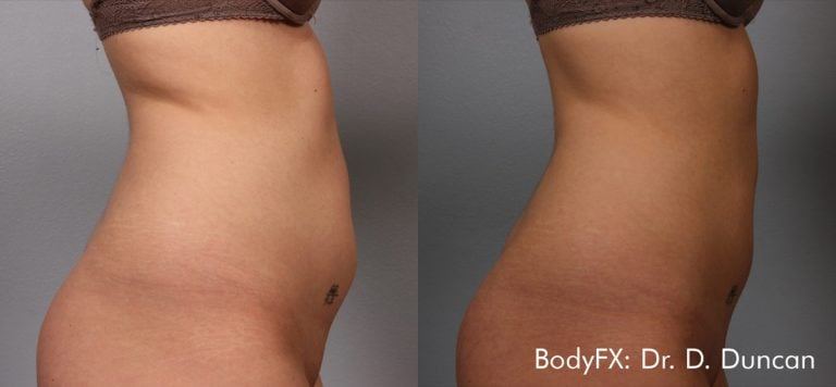 BodyFX - 7