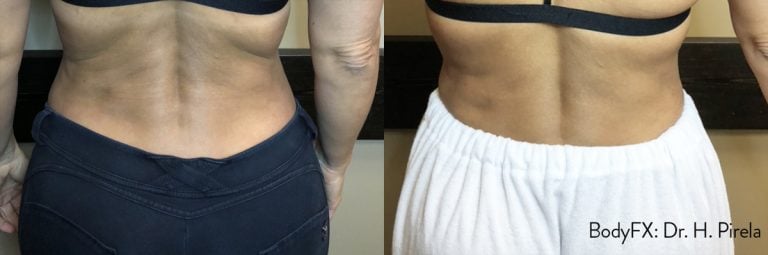BodyFX - 8
