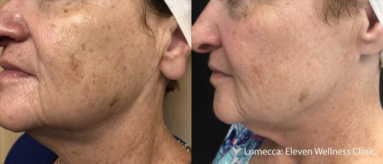 Lumecca Scaled - 27