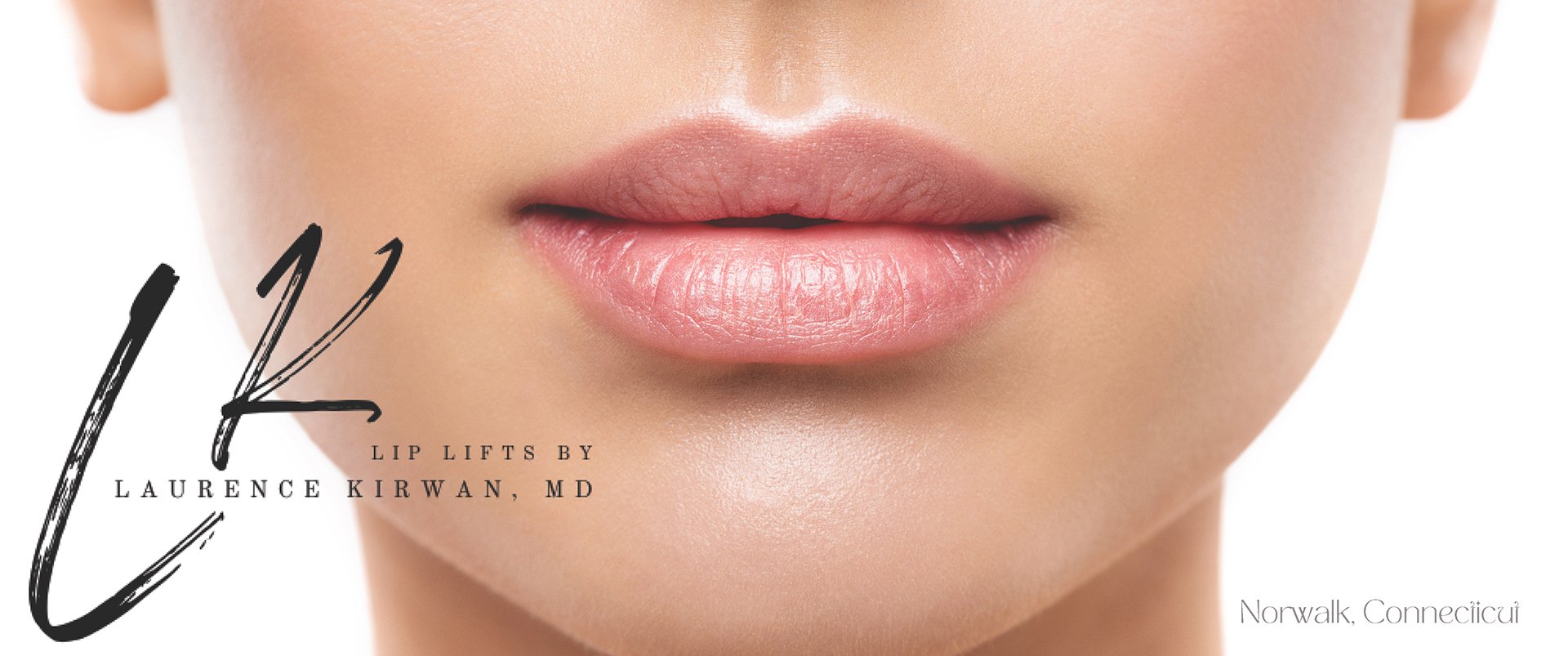 Lip Lift Top