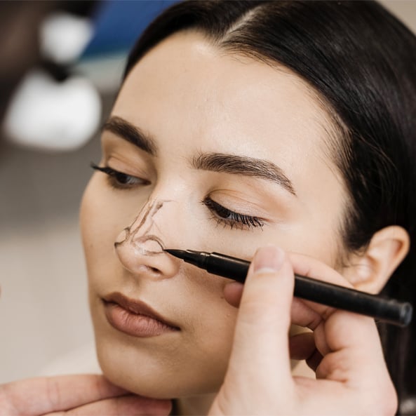 Rhinoplasty for Women