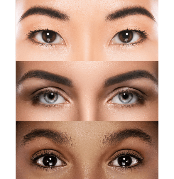 Who is the ideal candidate for blepharoplasty?