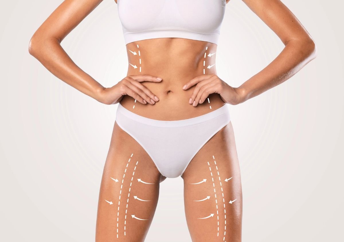 Is Liposuction Safe For Belly Fat? in Norwalk CT