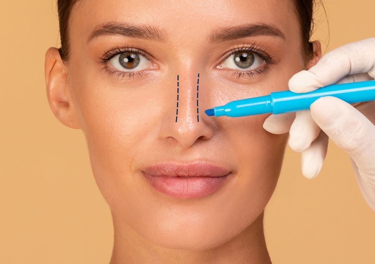 Nose Job in Norwalk CT