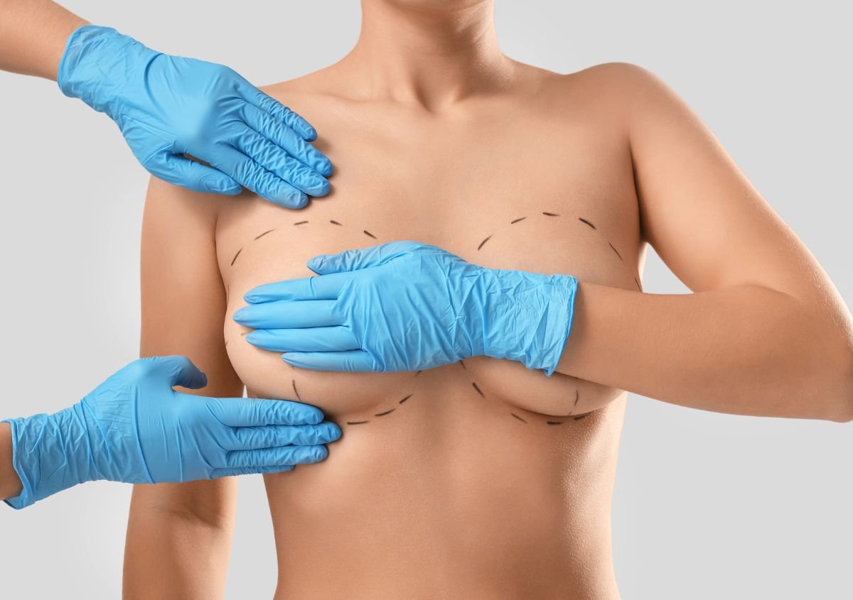What Age Is Okay For Breast Reduction in Norwalk CT
