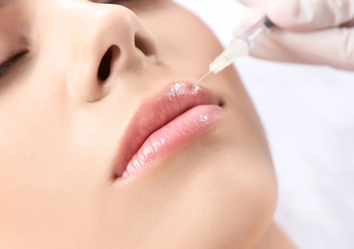 Philtrum Shortening in Norwalk CT