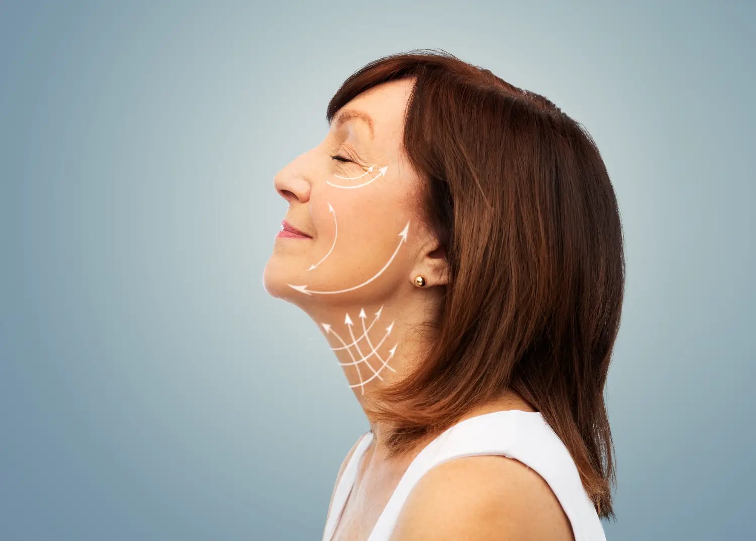 Preparing for Facelift Surgery: Steps to Optimize Recovery
