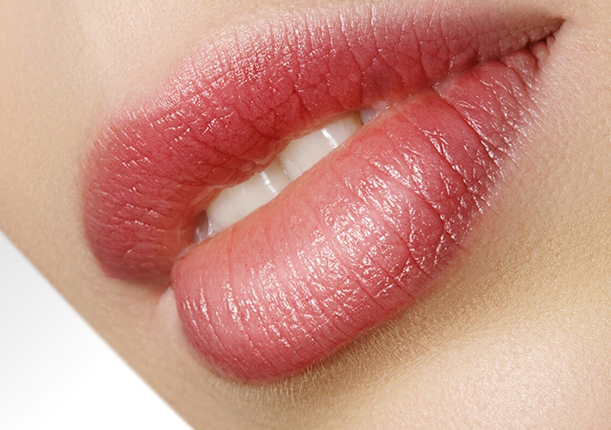 Philtrum of Upper Lip: Understanding Balance, Aesthetics, and Surgical Options